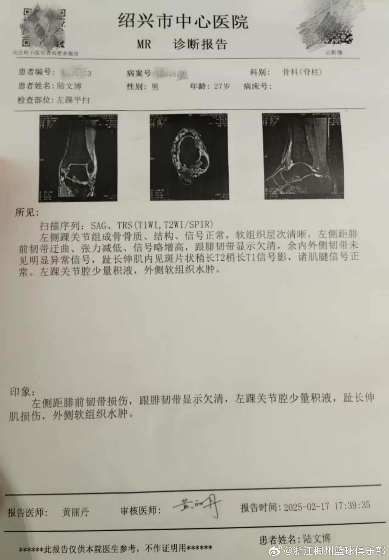 对战术的机